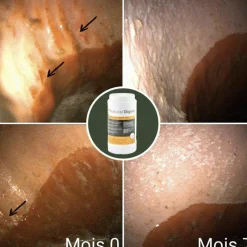 Ulcères Gastriques|Perte D'État*Natural' Innov - Complément digestif Natural'Digest